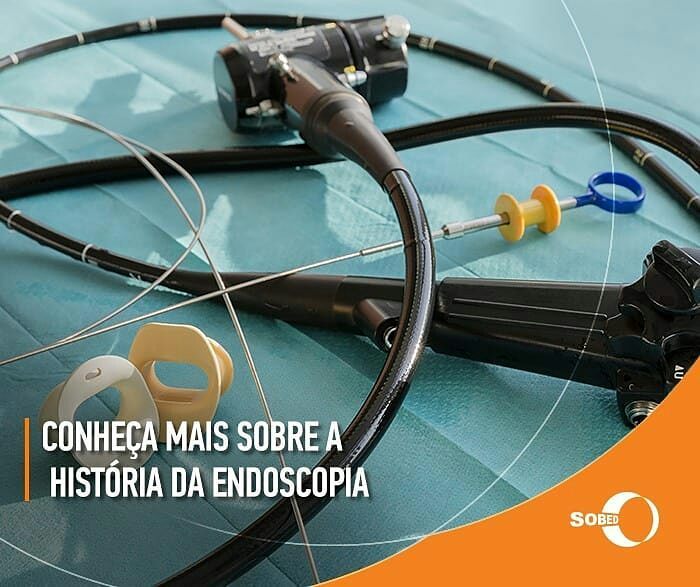 História da Endoscopia
