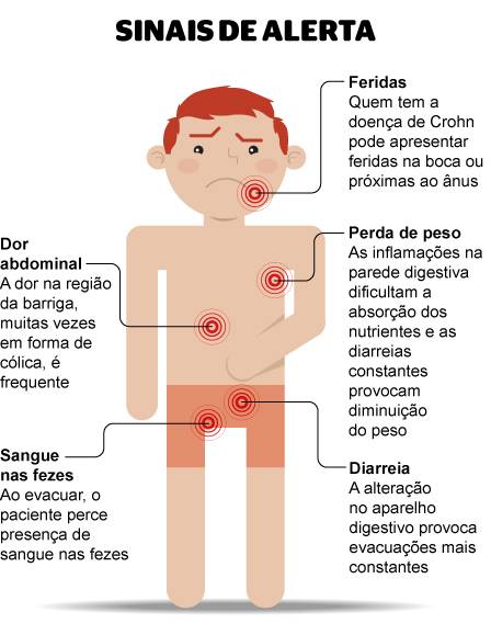Maio é o mês de alerta e conscientização para as doenças inflamatórias intestinais