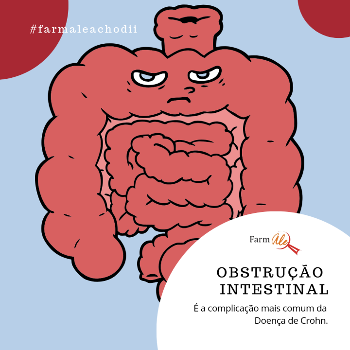 Obstrução Intestinal