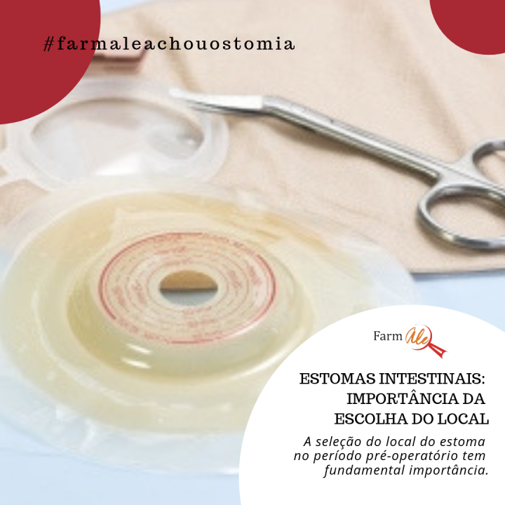 Estomas Intestinais: Importância da Escolha do Local