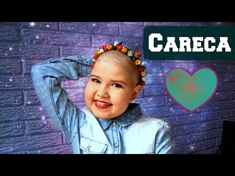 Lorena conta as vantagens e desvantagens de estar careca