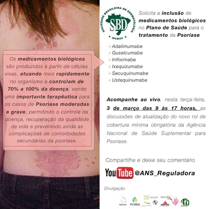 Reunião ANS – Psoríase