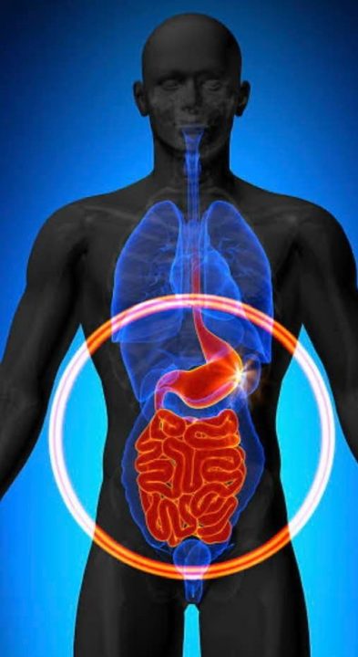 Dia Internacional das Doenças Inflamatórias Intestinais