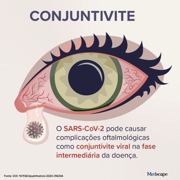 Covid-19 e Conjuntivite