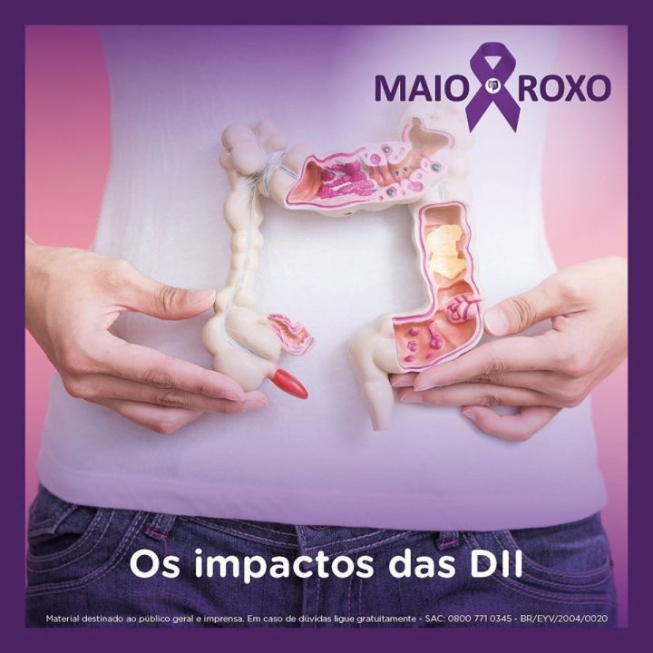⁣⁣⁣⁣Impactos Da Doença Inflamatória Intestinal