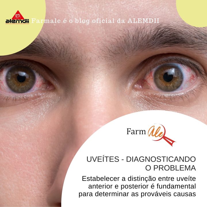 Uveítes – Diagnosticando o problema