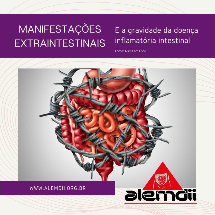 Manifestações Extraintestinais e gravidade da doença inflamatória intestinal