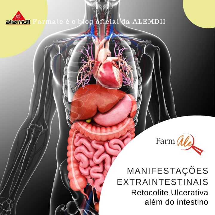 Retocolite Ulcerativa além do intestino