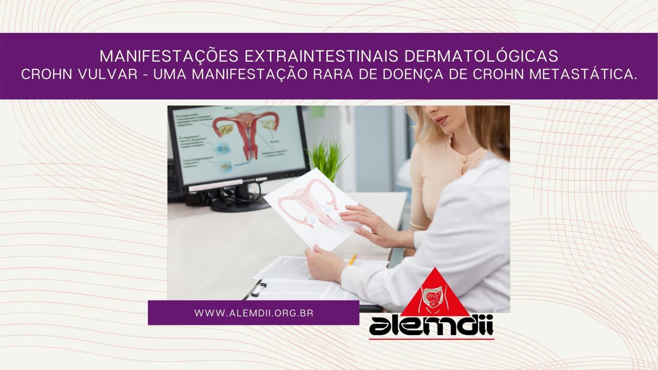Crohn Vulvar