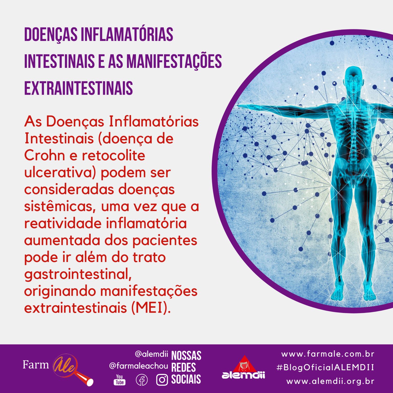 Doenças Inflamatórias Intestinais E As Manifestações Extraintestinais Farmale 