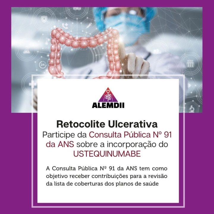 Participe da Consulta Pública Nº 91 da ANS sobre a incorporação do USTEQUINUMABE para Retocolite Ulcerativa