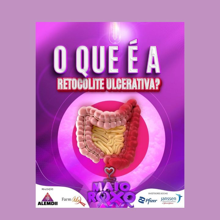 Informações sobre a Retocolite Ulcerativa
